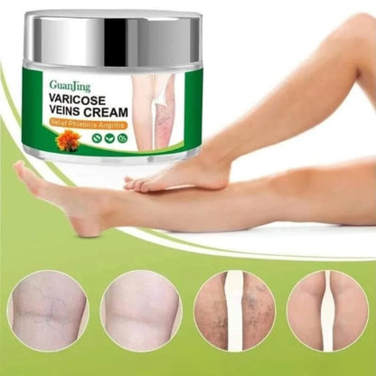 CREMA PARA LAS VARICES