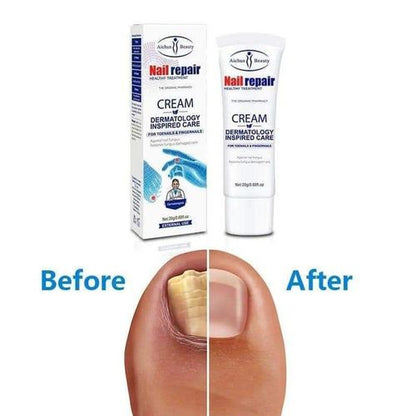 CREMA ANTIHONGOS DE UÑAS DE PIES Y MANOS