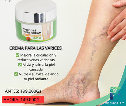 CREMA PARA LAS VARICES