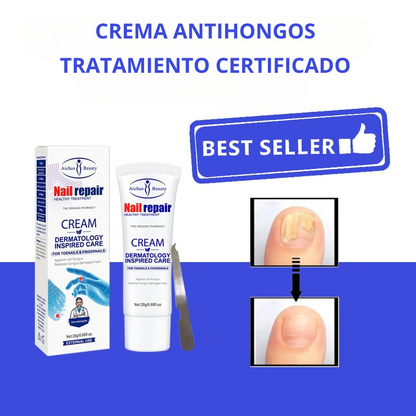 CREMA ANTIHONGOS DE UÑAS DE PIES Y MANOS