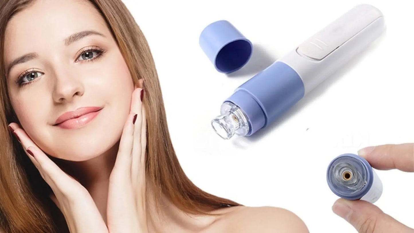 SUCCIONADOR DE PUNTOS NEGROS