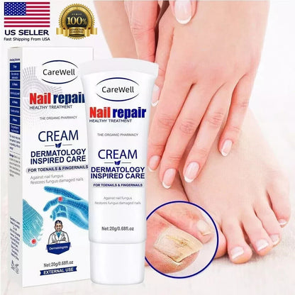 CREMA ANTIHONGOS DE UÑAS DE PIES Y MANOS